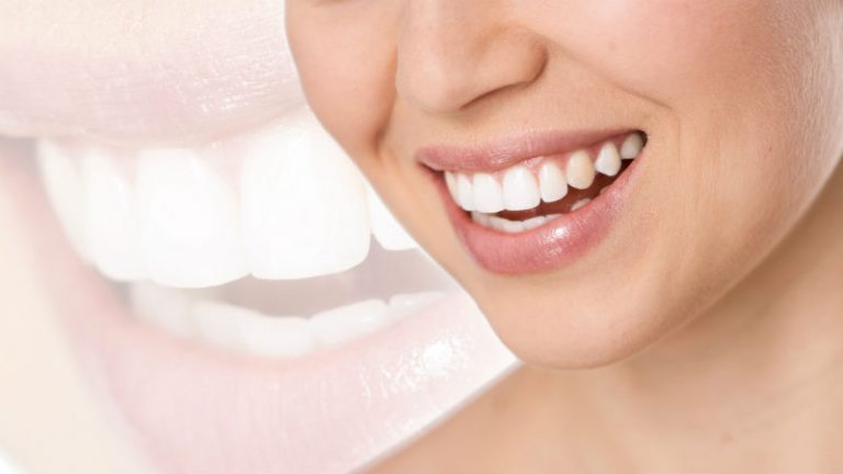 How Can Cosmetic Dentistry in Fairfield County CT Improve Your Smile?