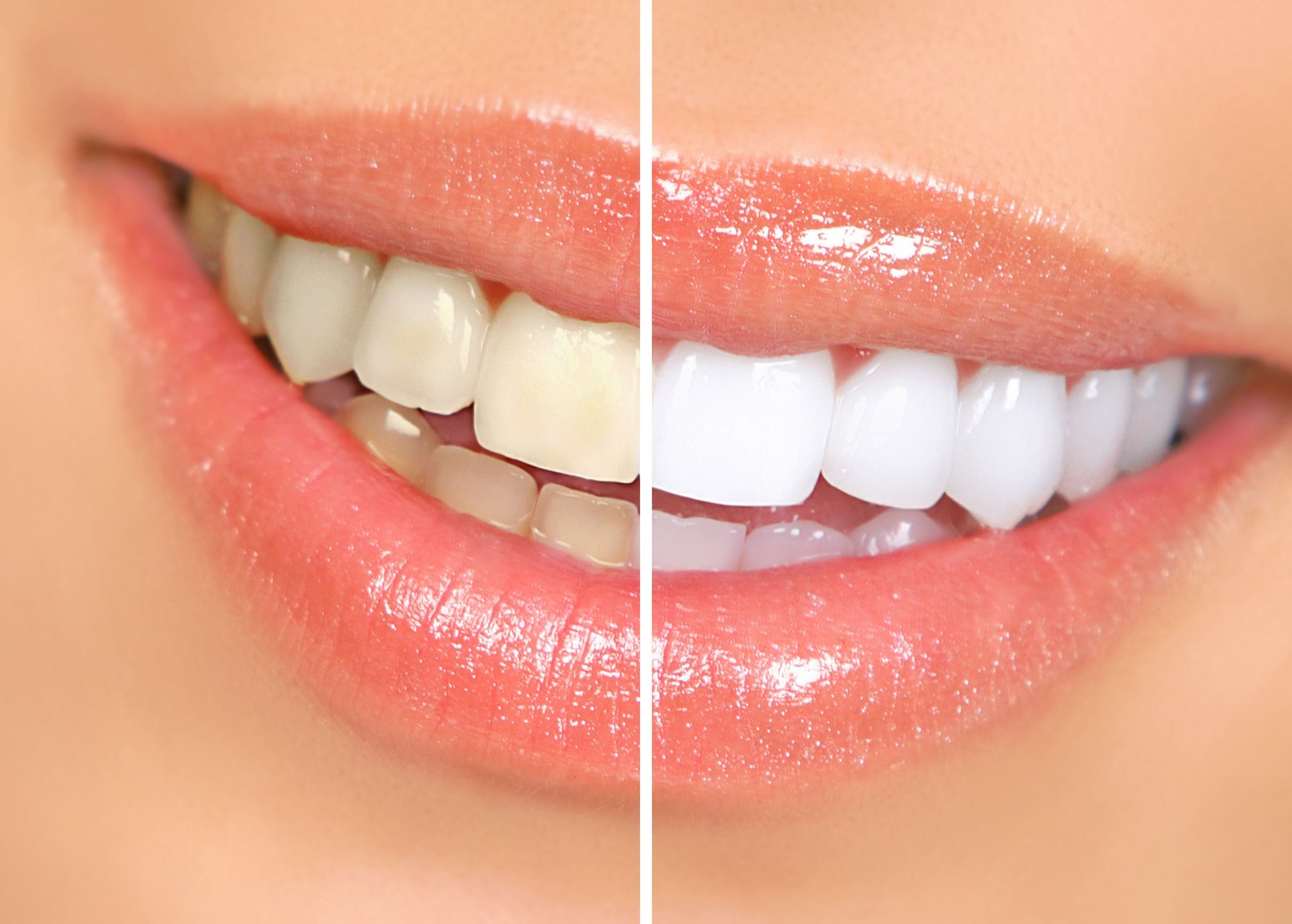 Benefits of Cosmetic Dentistry in Panama City Beach, FL