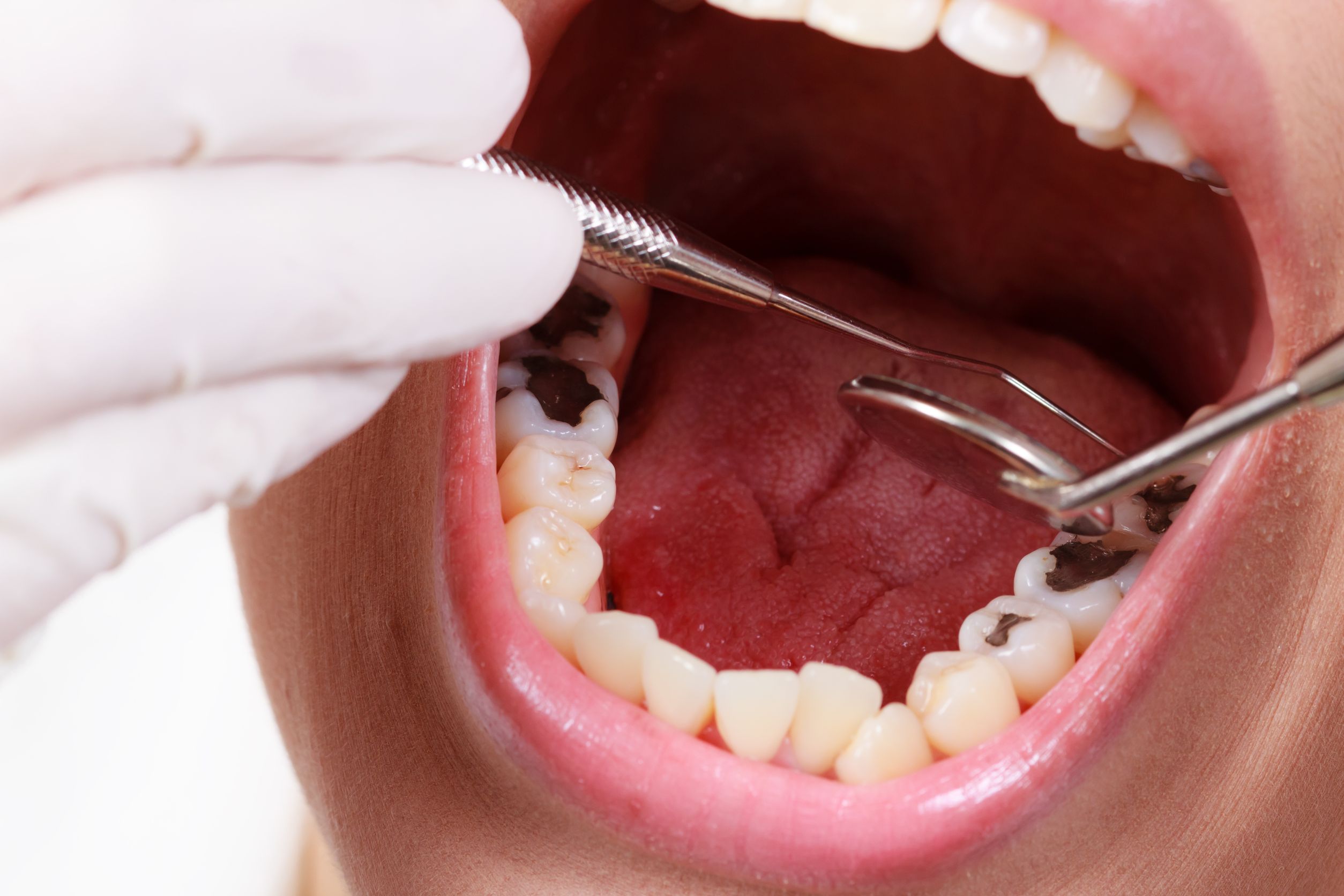 Is Restorative Dentistry in Torrance, CA Right for You?